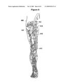 Removable Covering for Implantable Frame Projections diagram and image