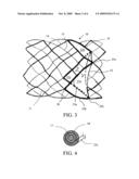 Valved stent for chronic venous insufficiency diagram and image