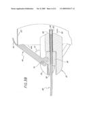 Method and Apparatuses for Deploying Minimally-Invasive Heart Valves diagram and image