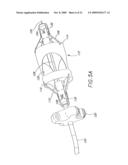 Method and Apparatuses for Deploying Minimally-Invasive Heart Valves diagram and image