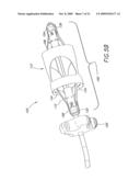 Method and Apparatuses for Deploying Minimally-Invasive Heart Valves diagram and image