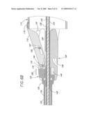 Method and Apparatuses for Deploying Minimally-Invasive Heart Valves diagram and image