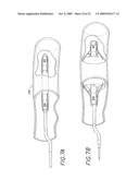 Method and Apparatuses for Deploying Minimally-Invasive Heart Valves diagram and image