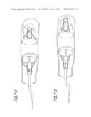 Method and Apparatuses for Deploying Minimally-Invasive Heart Valves diagram and image