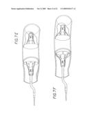 Method and Apparatuses for Deploying Minimally-Invasive Heart Valves diagram and image