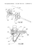 Method and Apparatuses for Deploying Minimally-Invasive Heart Valves diagram and image