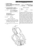 SYSTEM FOR IMPROVING CARDIAC FUNCTION BY SEALING A PARTITIONING MEMBRANE WITHIN A VENTRICLE diagram and image