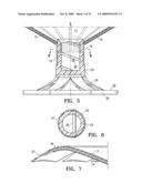 SYSTEM FOR IMPROVING CARDIAC FUNCTION BY SEALING A PARTITIONING MEMBRANE WITHIN A VENTRICLE diagram and image