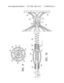 SYSTEM FOR IMPROVING CARDIAC FUNCTION BY SEALING A PARTITIONING MEMBRANE WITHIN A VENTRICLE diagram and image