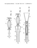 SYSTEM FOR IMPROVING CARDIAC FUNCTION BY SEALING A PARTITIONING MEMBRANE WITHIN A VENTRICLE diagram and image