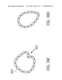 SYSTEM FOR IMPROVING CARDIAC FUNCTION BY SEALING A PARTITIONING MEMBRANE WITHIN A VENTRICLE diagram and image