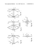 Standardized compression bar system for a braced front construction diagram and image