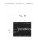 Semiconductor device including an ohmic layer diagram and image