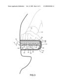 Impact Absorbing Armrest for a Motor Vehicle diagram and image