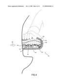 Impact Absorbing Armrest for a Motor Vehicle diagram and image