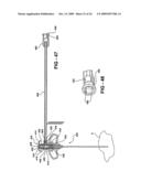 BONE CEMENT MIXING AND DELIVERY SYSTEM WITH AUTOMATED BONE CEMENT TRANSFER BETWEEN MIXER AND DELIVERY DEVICE AND METHOD OF MIXING AND AUTOMATED TRANSFER OF BONE CEMENT BETWEEN MIXER AND DELIVERY DEVICE AND METHOD OF MIXING AND AUTOMATED TRANSFER OF BONE CEMENT BETWEEN MIXER AND DELIVERY DEVICE diagram and image