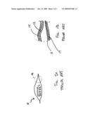 PACKAGE FOF COOKING FOODSTUFFS HAVING HIGH-MOISTURE CONTENT diagram and image