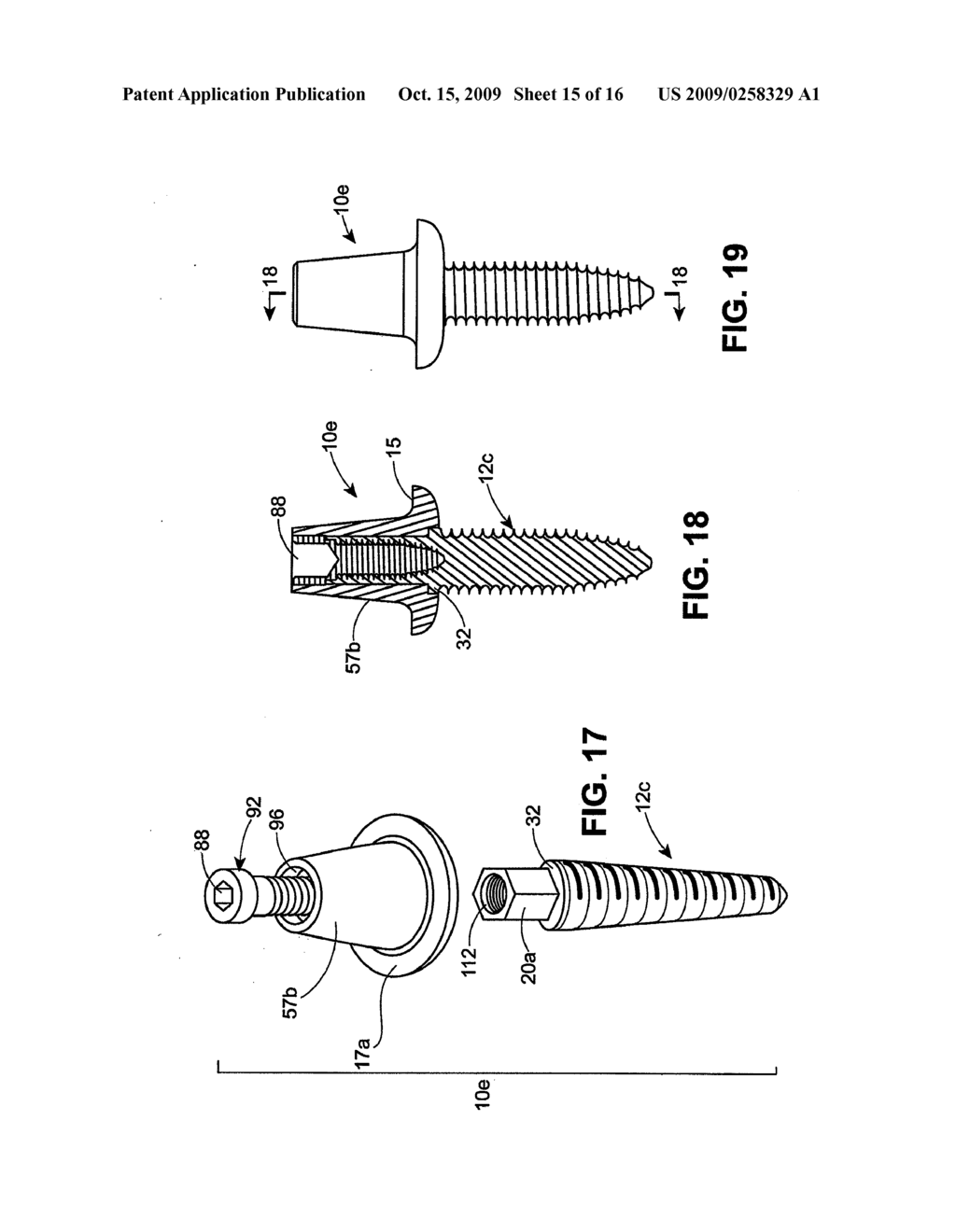 DENTAL IMPLANT - diagram, schematic, and image 16