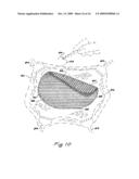 SURFACE MODIFIED EXPANDED POLYTETRAFLUOROETHYLENE DEVICES AND METHODS OF PRODUCING THE SAME diagram and image