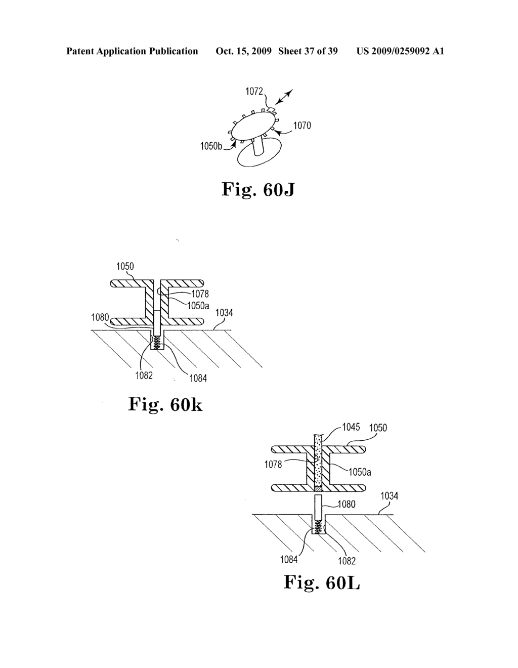 Adjustable Sling and Method of Treating Pelvic Conditions - diagram, schematic, and image 38