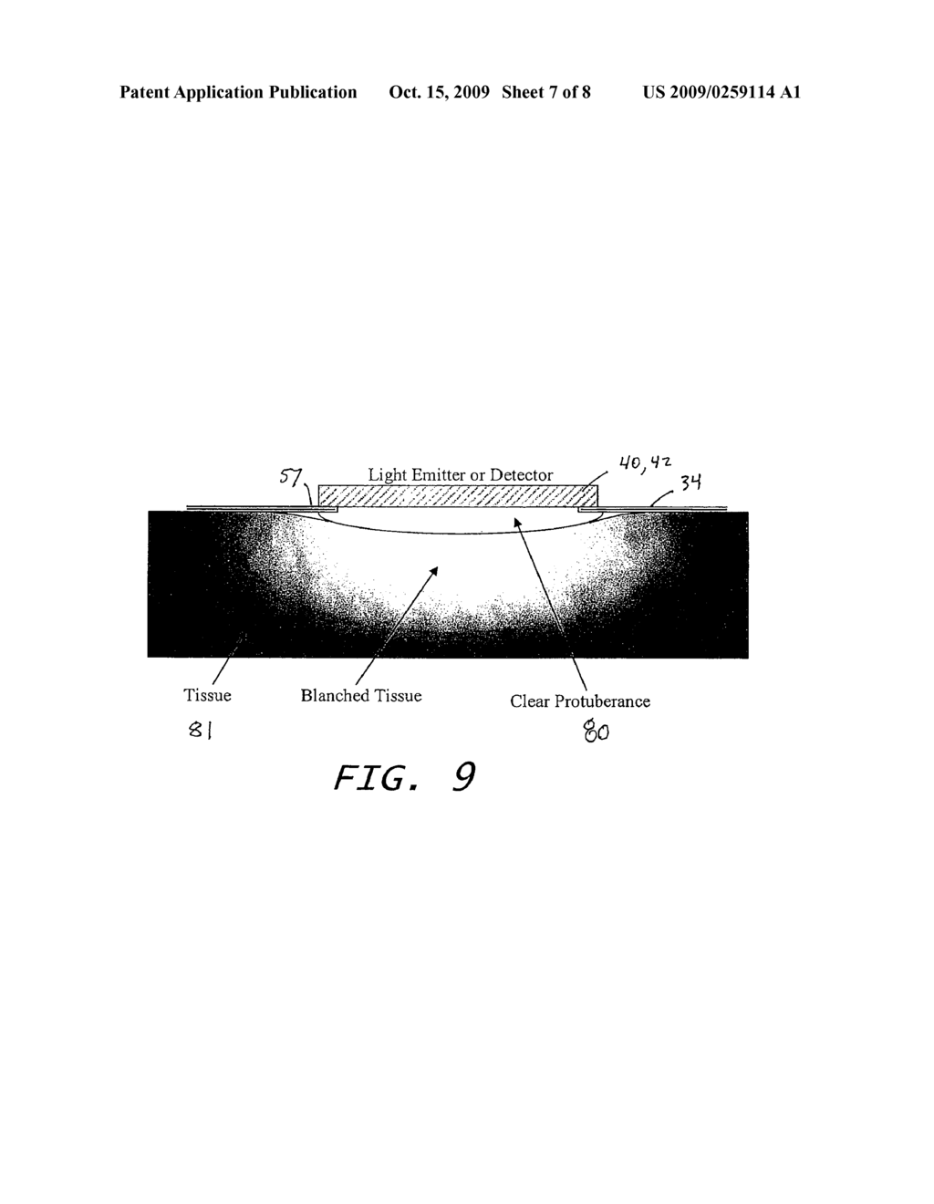 NON-INVASIVE OPTICAL SENSOR - diagram, schematic, and image 08