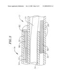 CATHETER HAVING MAPPING ASSEMBLY diagram and image