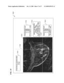 DEVICE AND METHOD FOR MRI-GUIDED BREAST INTERVENTIONS diagram and image