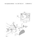 METHOD AND DEVICE FOR 3D ACQUISITION, 3D VISUALIZATION AND COMPUTER GUIDED SURGERY USING NUCLEAR PROBES diagram and image