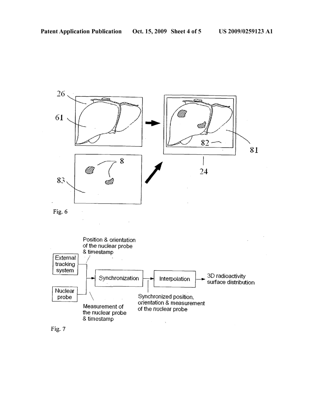 METHOD AND DEVICE FOR 3D ACQUISITION, 3D VISUALIZATION AND COMPUTER GUIDED SURGERY USING NUCLEAR PROBES - diagram, schematic, and image 05