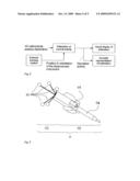 METHOD AND DEVICE FOR 3D ACQUISITION, 3D VISUALIZATION AND COMPUTER GUIDED SURGERY USING NUCLEAR PROBES diagram and image