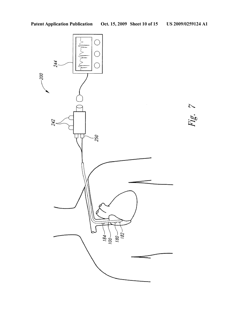 METHOD OF LOCATING THE TIP OF A CENTRAL VENOUS CATHETER - diagram, schematic, and image 11