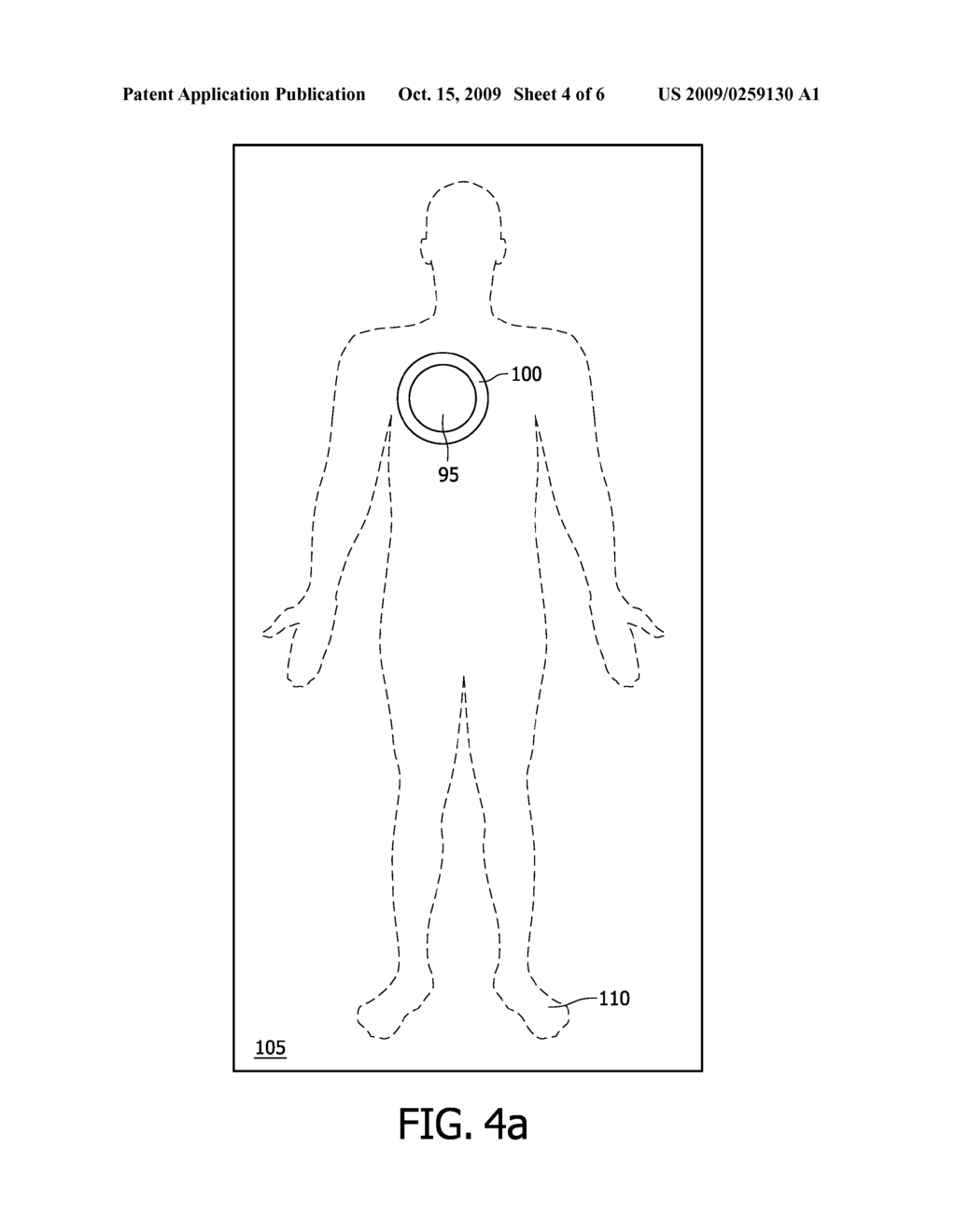 OPTICAL TOMOGRAPHY MEASUREMENT USING AN ADAPTED BRIM FOR THE RECEIVING VOLUME - diagram, schematic, and image 05