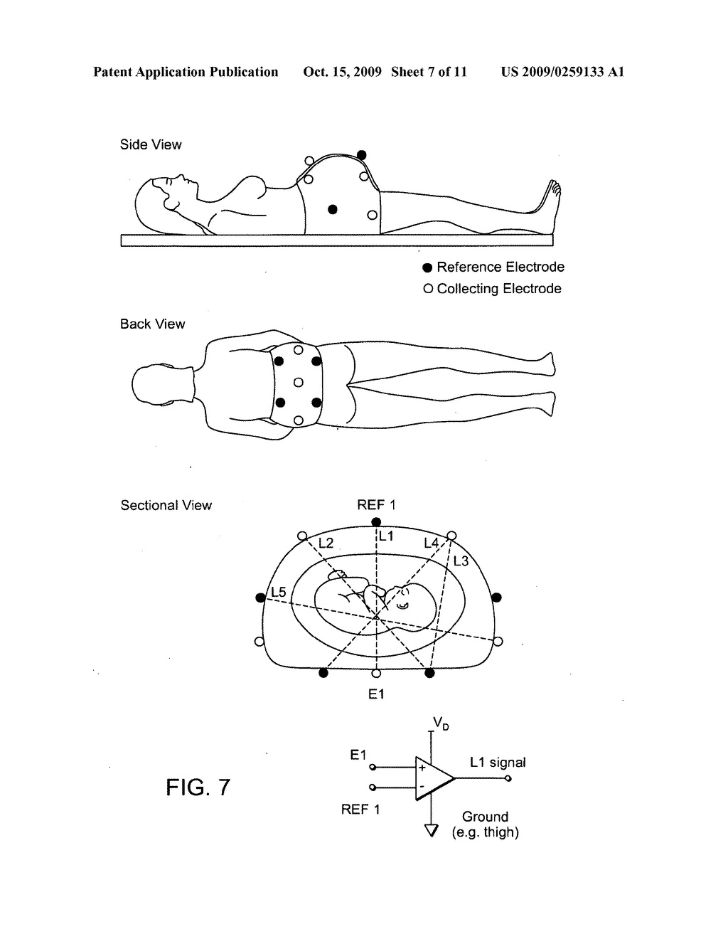 FETAL ECG MONITORING - diagram, schematic, and image 08