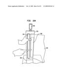 Triple modality wound treatment device diagram and image