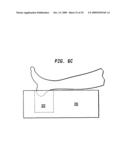 Triple modality wound treatment device diagram and image