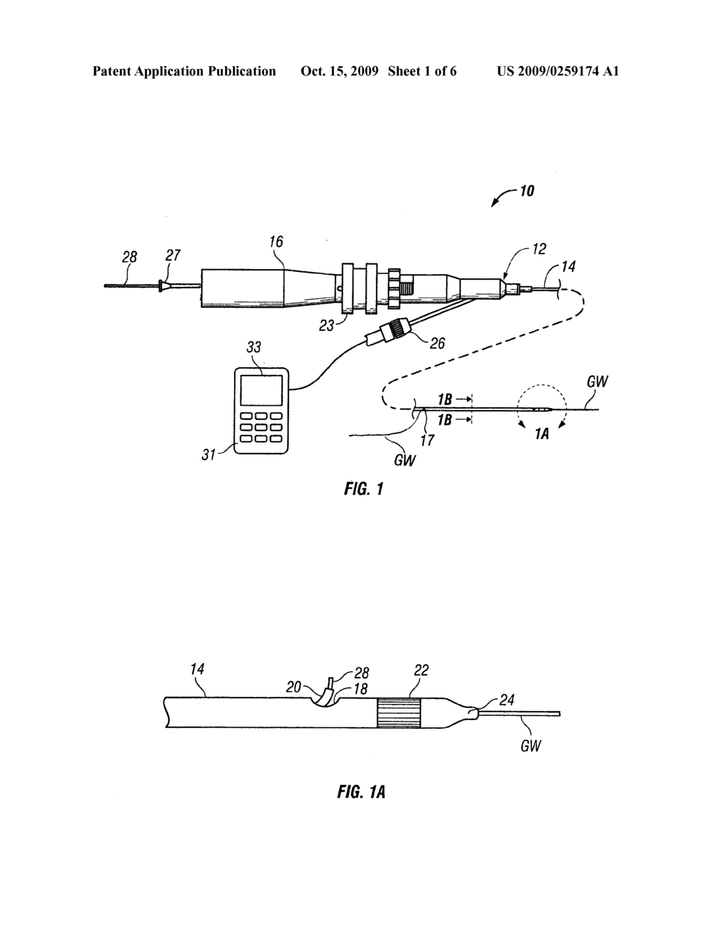 Methods and devices for treating vulnerable atherosclerotic plaque - diagram, schematic, and image 02