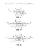 RESORBABLE HOLLOW DEVICES FOR IMPLANTATION AND DELIVERY OF THERAPEUTIC AGENTS diagram and image