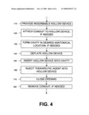 RESORBABLE HOLLOW DEVICES FOR IMPLANTATION AND DELIVERY OF THERAPEUTIC AGENTS diagram and image