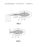 RESORBABLE HOLLOW DEVICES FOR IMPLANTATION AND DELIVERY OF THERAPEUTIC AGENTS diagram and image