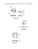 IMPLANTABLE INJECTION PORT diagram and image