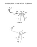 IMPLANTABLE INJECTION PORT diagram and image