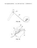 IMPLANTABLE INJECTION PORT diagram and image