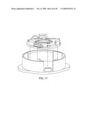 IMPLANTABLE INJECTION PORT diagram and image