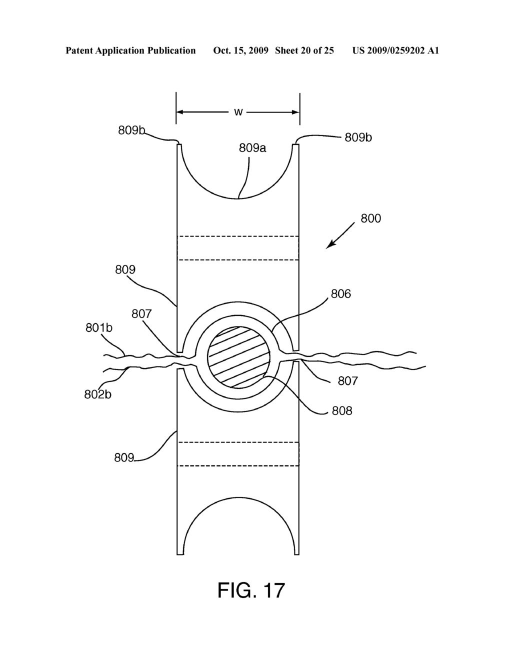 CATHETERS WITH LUBRICIOUS LININGS AND METHODS FOR MAKING AND USING THEM - diagram, schematic, and image 21