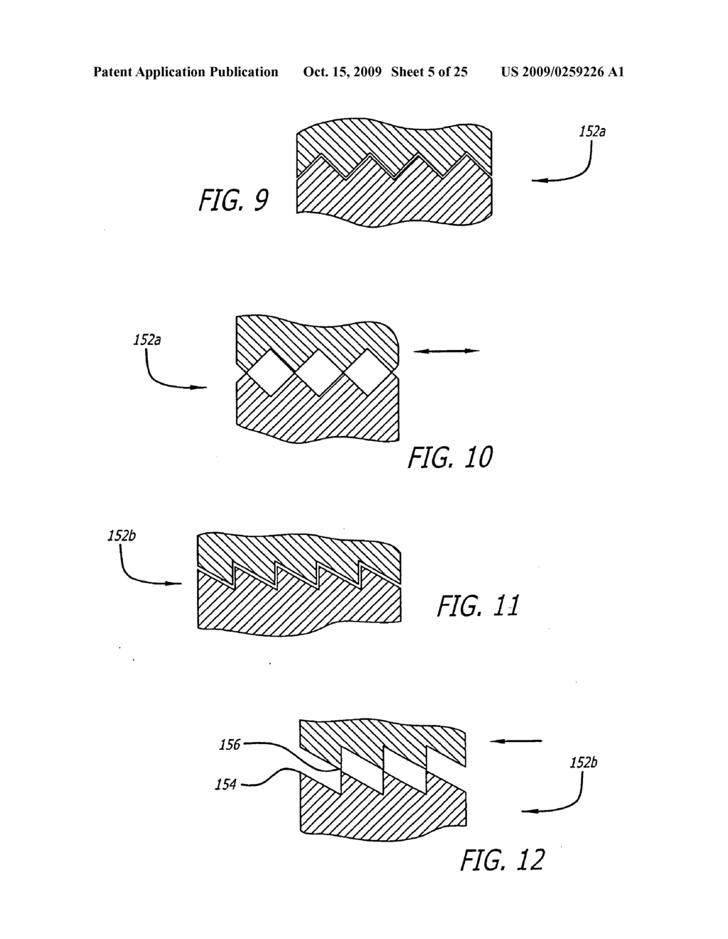 Method for installation of dynamic, single-lock anterior cervical plate system having non-detachably fastened and moveable segments - diagram, schematic, and image 06