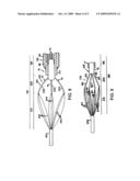 Surgical extractor diagram and image