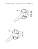 IMPLANTABLE DEVICE FASTENING SYSTEM AND METHODS OF USE diagram and image