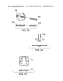 IMPLANTABLE DEVICE FASTENING SYSTEM AND METHODS OF USE diagram and image