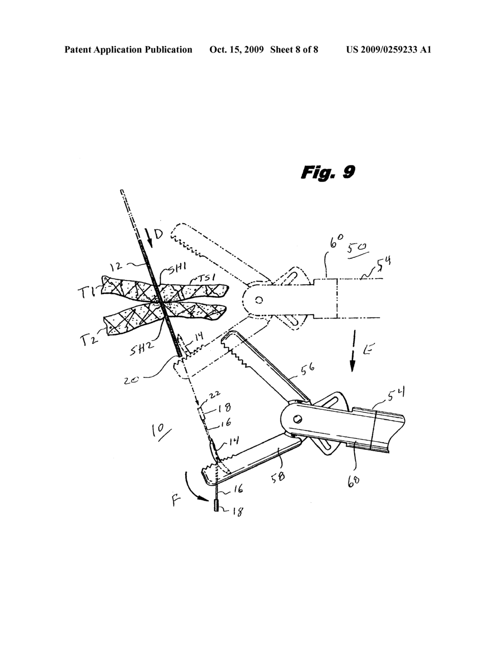 Deployment System For Surgical Suture - diagram, schematic, and image 09