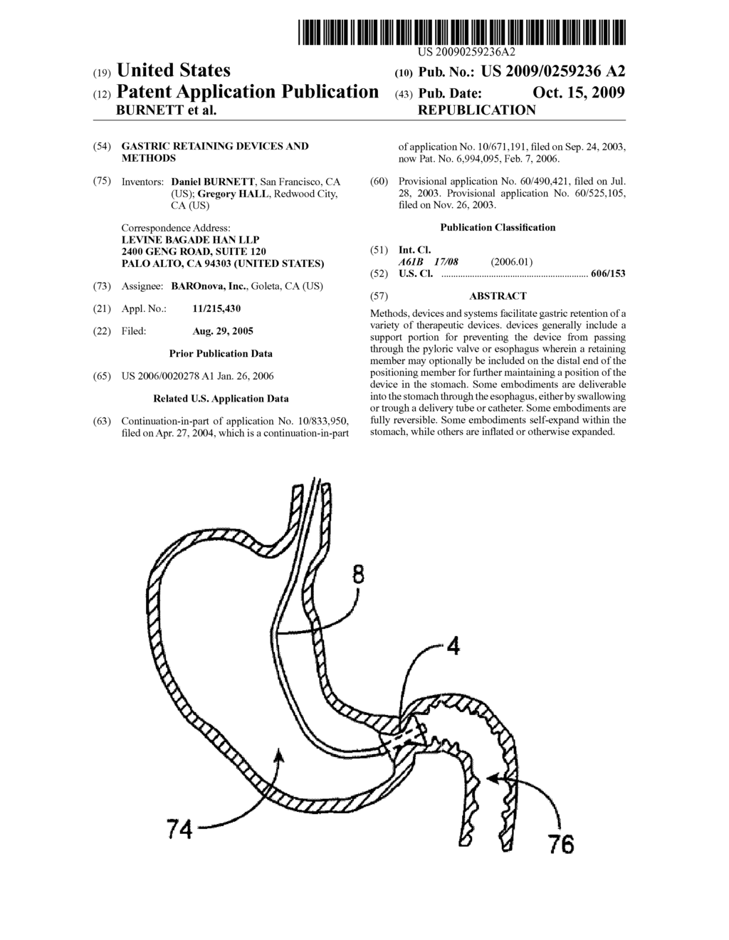 GASTRIC RETAINING DEVICES AND METHODS - diagram, schematic, and image 01